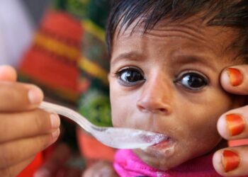 Une explosion catastrophique des taux de malnutrition sévère chez les enfants menace le monde, selon l’UNICEF