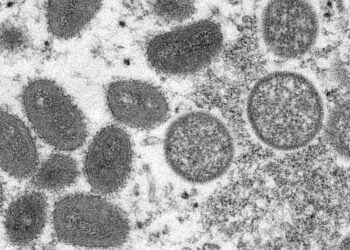 Variole du singe : l’apparition dans des pays non endémiques suggère une transmission non détectée – OMS