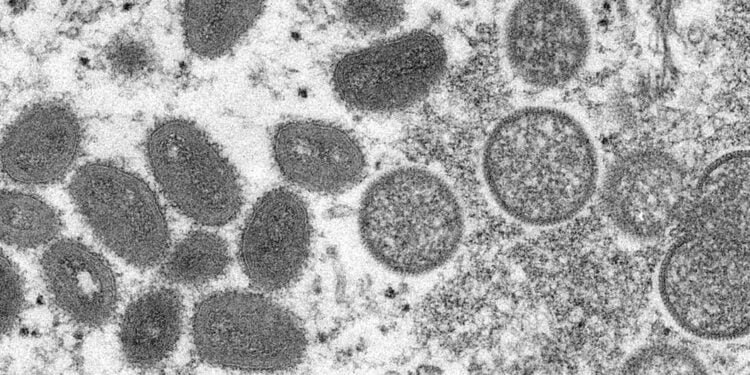 Variole du singe : l’apparition dans des pays non endémiques suggère une transmission non détectée – OMS