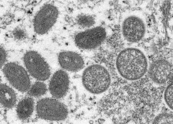 Variole du singe : l’OMS ne préconise pas une vaccination de masse