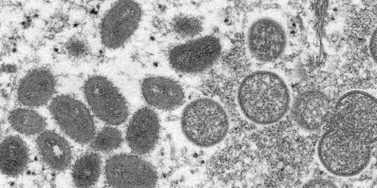 Variole du singe : l’OMS ne préconise pas une vaccination de masse