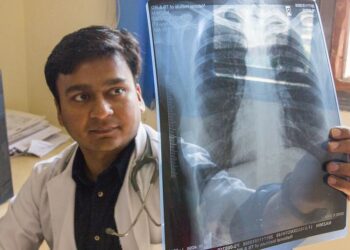 L’OMS veut renforcer les efforts de conception de vaccins contre la tuberculose