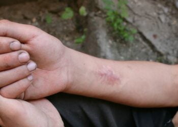 Drogues : l’ONU plaide pour une approche centrée sur les personnes pour lutter contre la stigmatisation