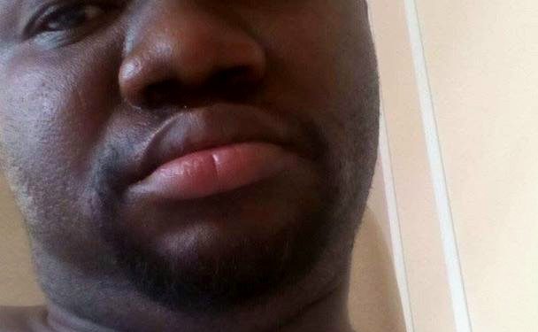 Guinée : SOS pour Joe Festi, pilier du Circus Baobab oublié de tous