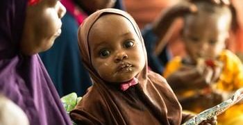 Un enfant reçoit un traitement contre la malnutrition dans un centre soutenu par l&rsquo;UNICEF à Dollow, en Somalie.