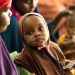 Un enfant reçoit un traitement contre la malnutrition dans un centre soutenu par l’UNICEF à Dollow, en Somalie.