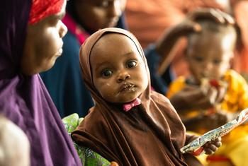 Un enfant reçoit un traitement contre la malnutrition dans un centre soutenu par l’UNICEF à Dollow, en Somalie.