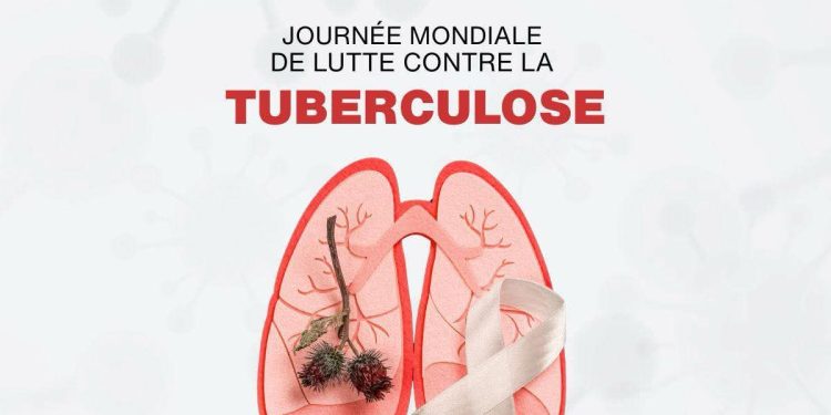 Journée mondiale de lutte contre la tuberculose : le Groupe UMS renouvelle son engagement pour la santé de tous