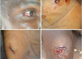 Conflit foncier autour de Gnara Beli : la tension monte entre Yimaya Dabbo et Farenya, plusieurs arrestations signalées