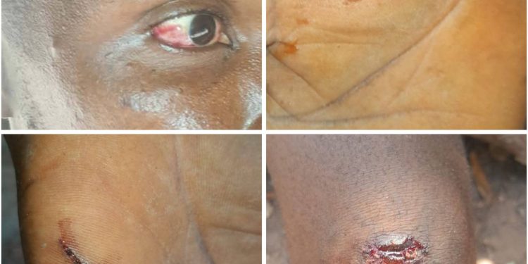 Conflit foncier autour de Gnara Beli : la tension monte entre Yimaya Dabbo et Farenya, plusieurs arrestations signalées