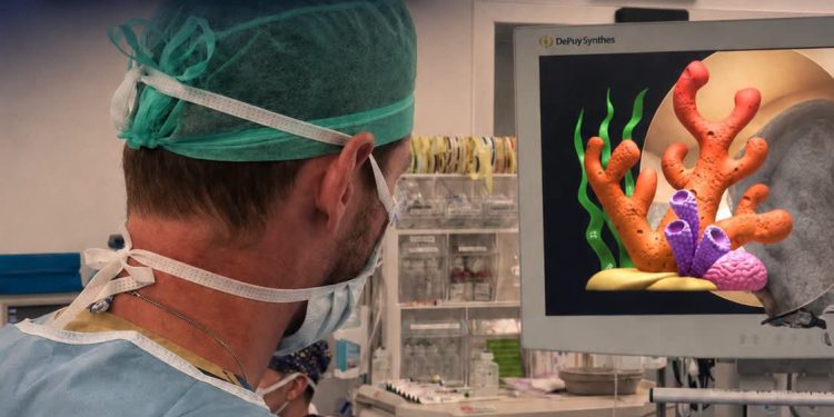 Médecine : en Israël, un implant à base de corail ouvre une nouvelle voie pour réparer le cartilage du genou